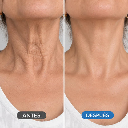 Rejuvenece tu cuello en 14 días - LumiNeck®